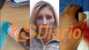 Una gresca en General Acha terminó con una policía herida por un botellazo