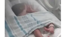 Un bebé de Chimbas sigue mejorando en Córdoba tras una operación inédita en América Latina