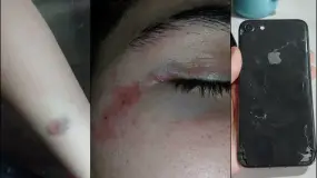 Denunció un robo, salieron a buscarlo y terminaron bajo una lluvia de piedras en Aramburu