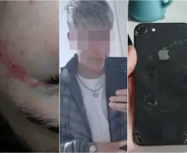 Una joven acusó a un hombre del Barrio Aramburu por un robo y un ataque a piedrazos
