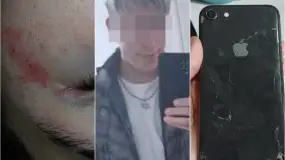 Una joven acusó a un hombre del Barrio Aramburu por un robo y un ataque a piedrazos